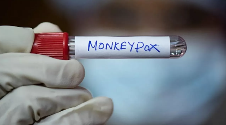 WHO cảnh báo sự bùng phát bệnh đậu mùa khỉ ở châu Phi với hơn 14.700 ca mắc